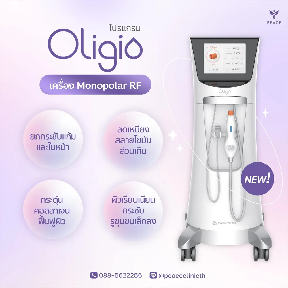 โปรแกรม Oligio ช่วยเรื่องอะไรบ้าง ?