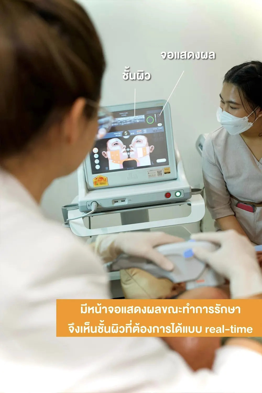 บรรยากาศการทำ Ultherapy Prime ที่ Peace Clinic 1