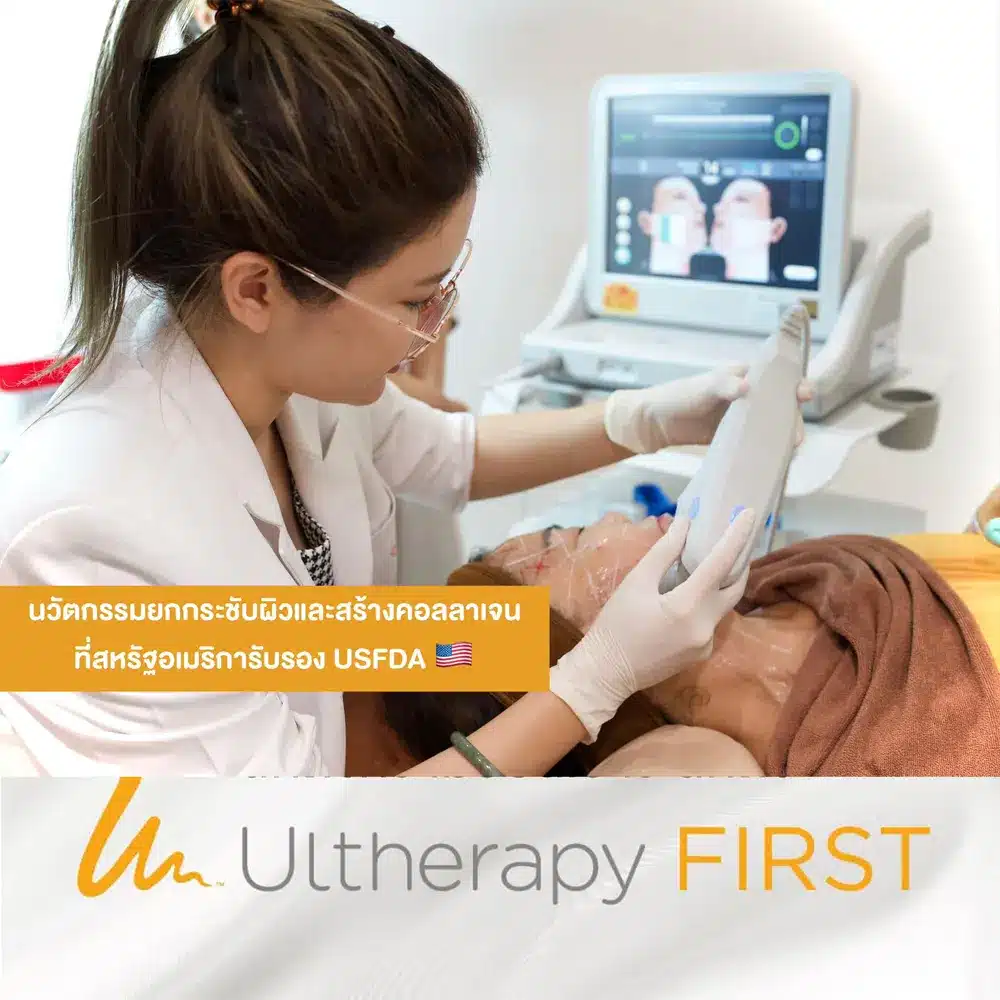 บรรยากาศการทำ Ultherapy Prime ที่ Peace Clinic 3
