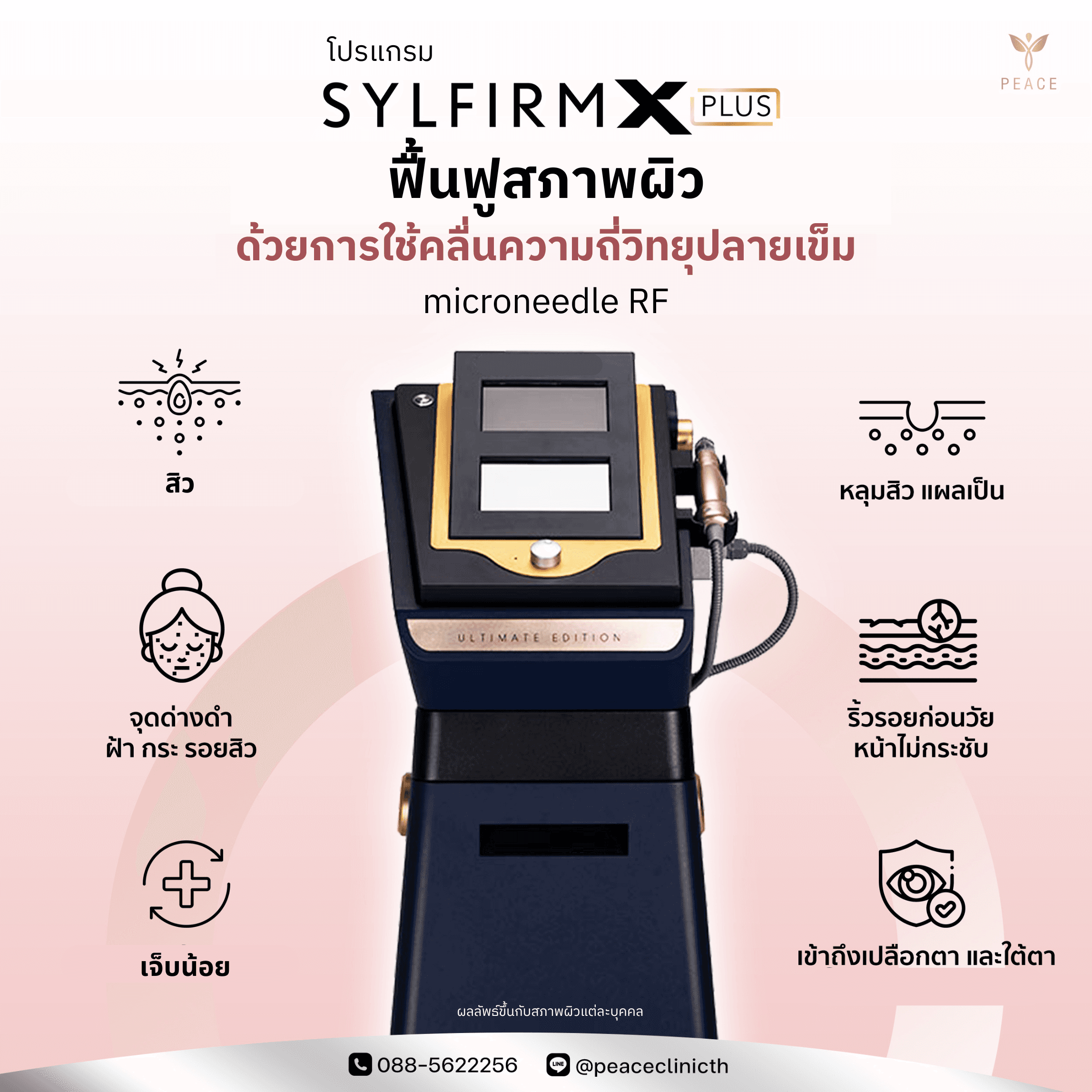 โปรแกรม Sylfirm X Plus ช่วยเรื่องอะไรบ้าง ?