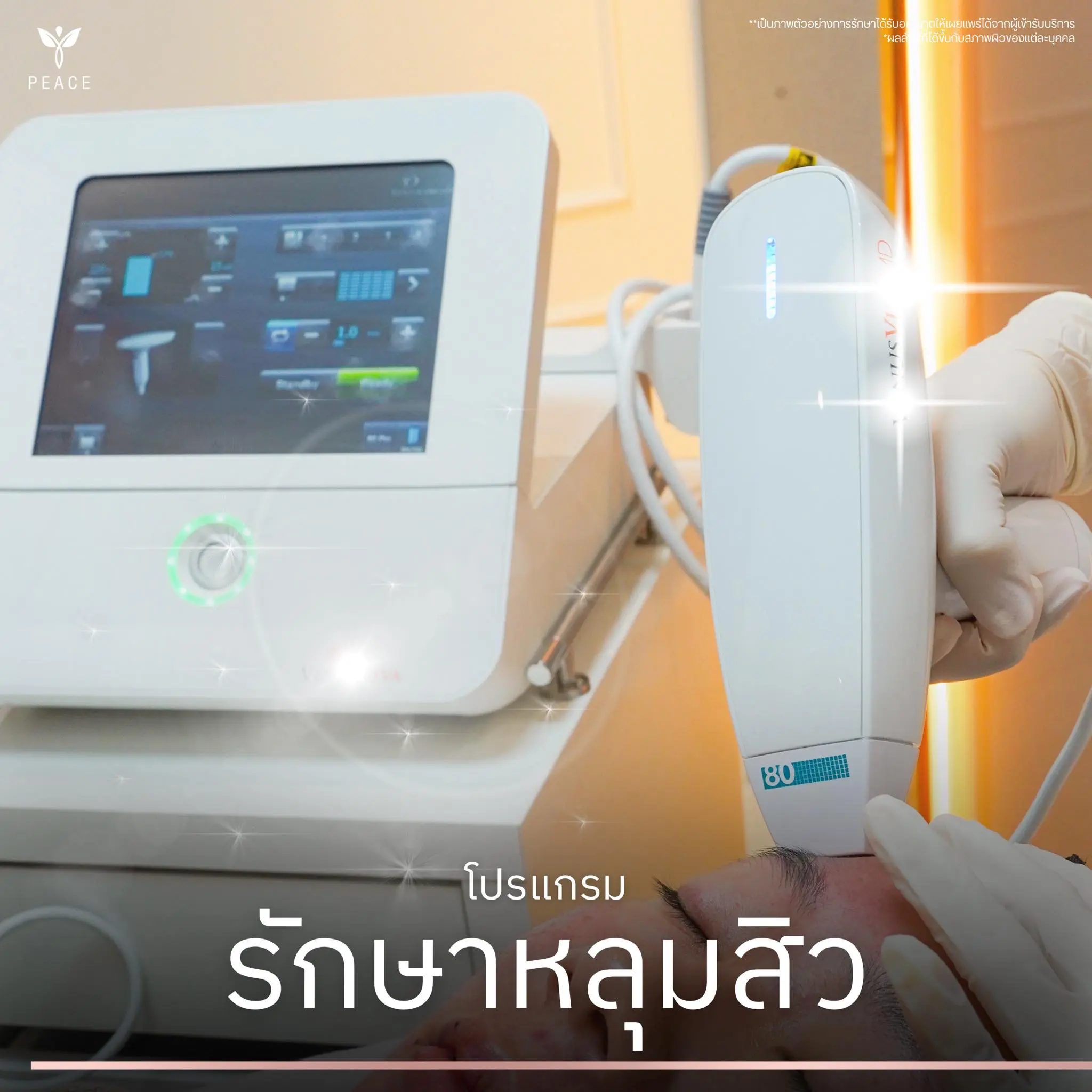โปรแกรม Venus Viva MD ช่วยดูแลเรื่องใดบ้าง?