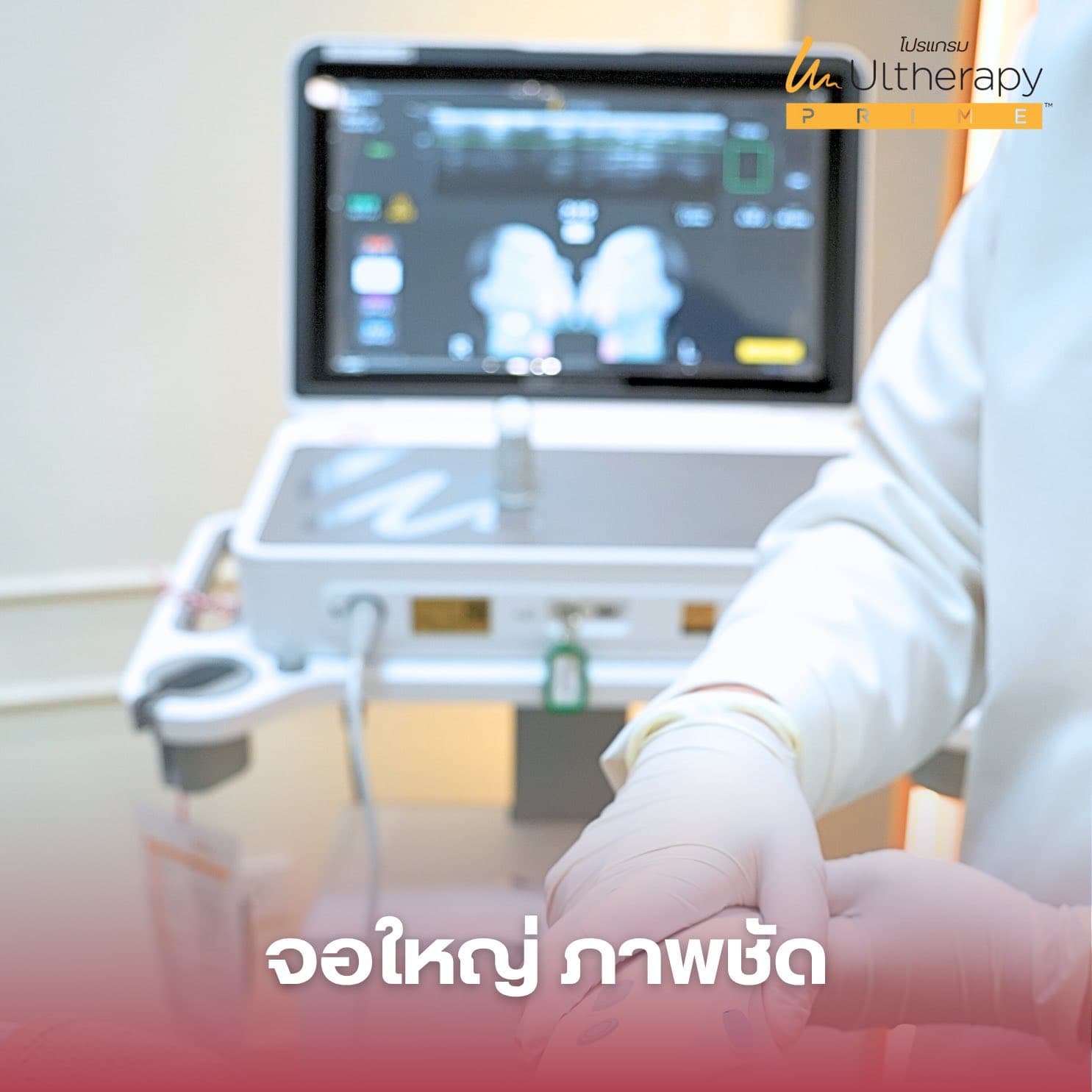 Ultherapy PRIME โปรแกรมยกกระชับ ที่เห็นชัดทุกชั้นผิว 2