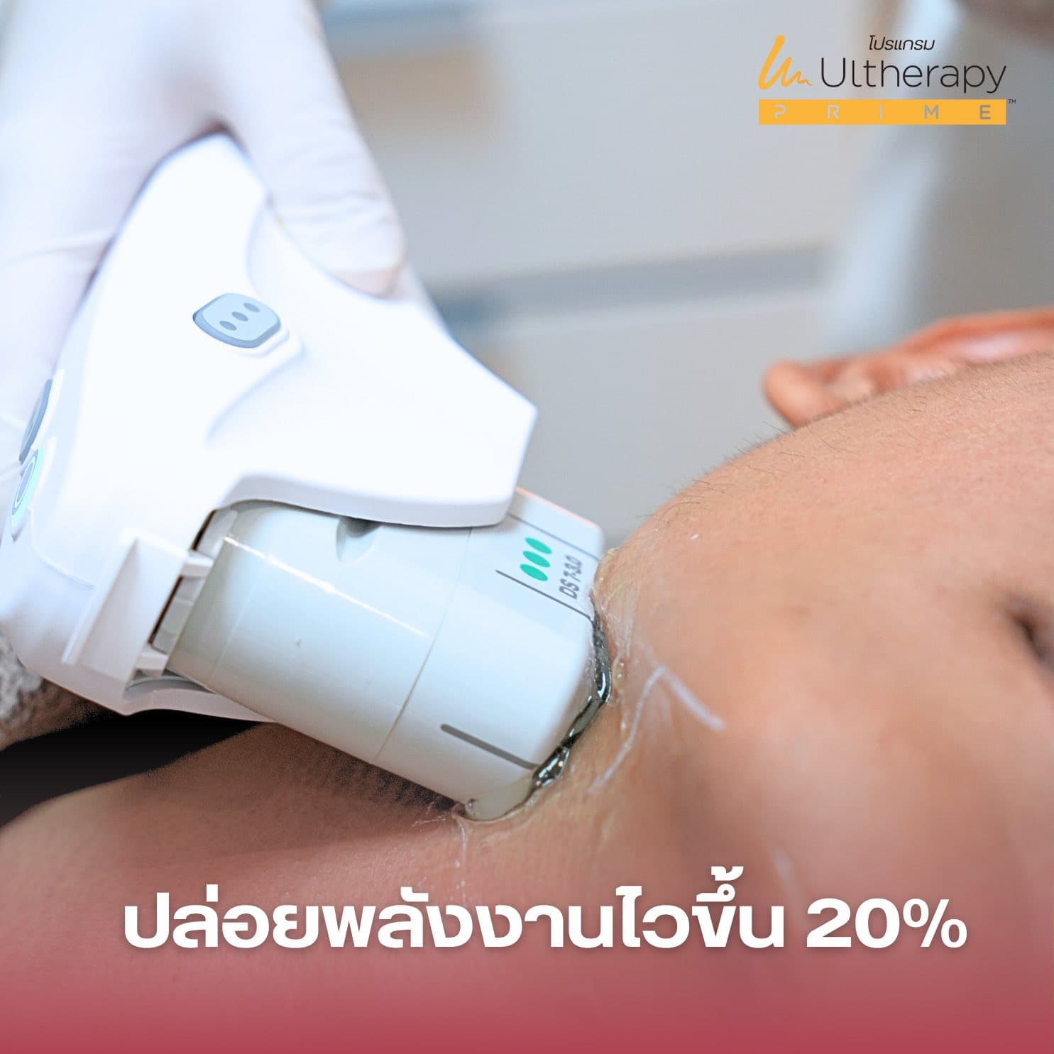 Ultherapy PRIME โปรแกรมยกกระชับ ที่เห็นชัดทุกชั้นผิว 3