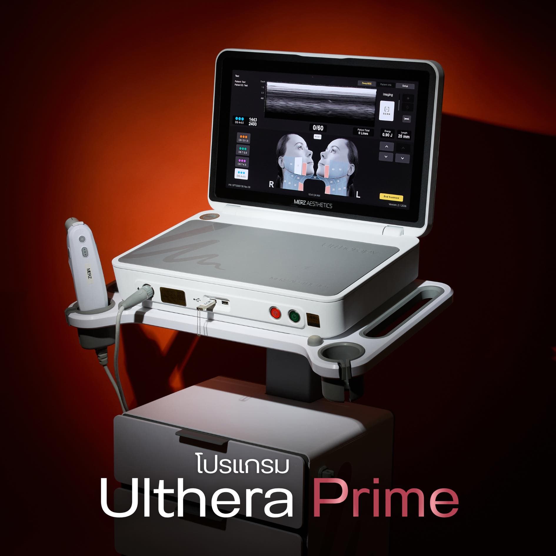 โปรแกรม Ultherapy Prime ช่วยเรื่องอะไรบ้าง ?