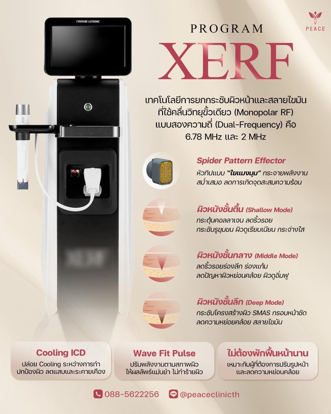 โปรแกรม XERF คืออะไร