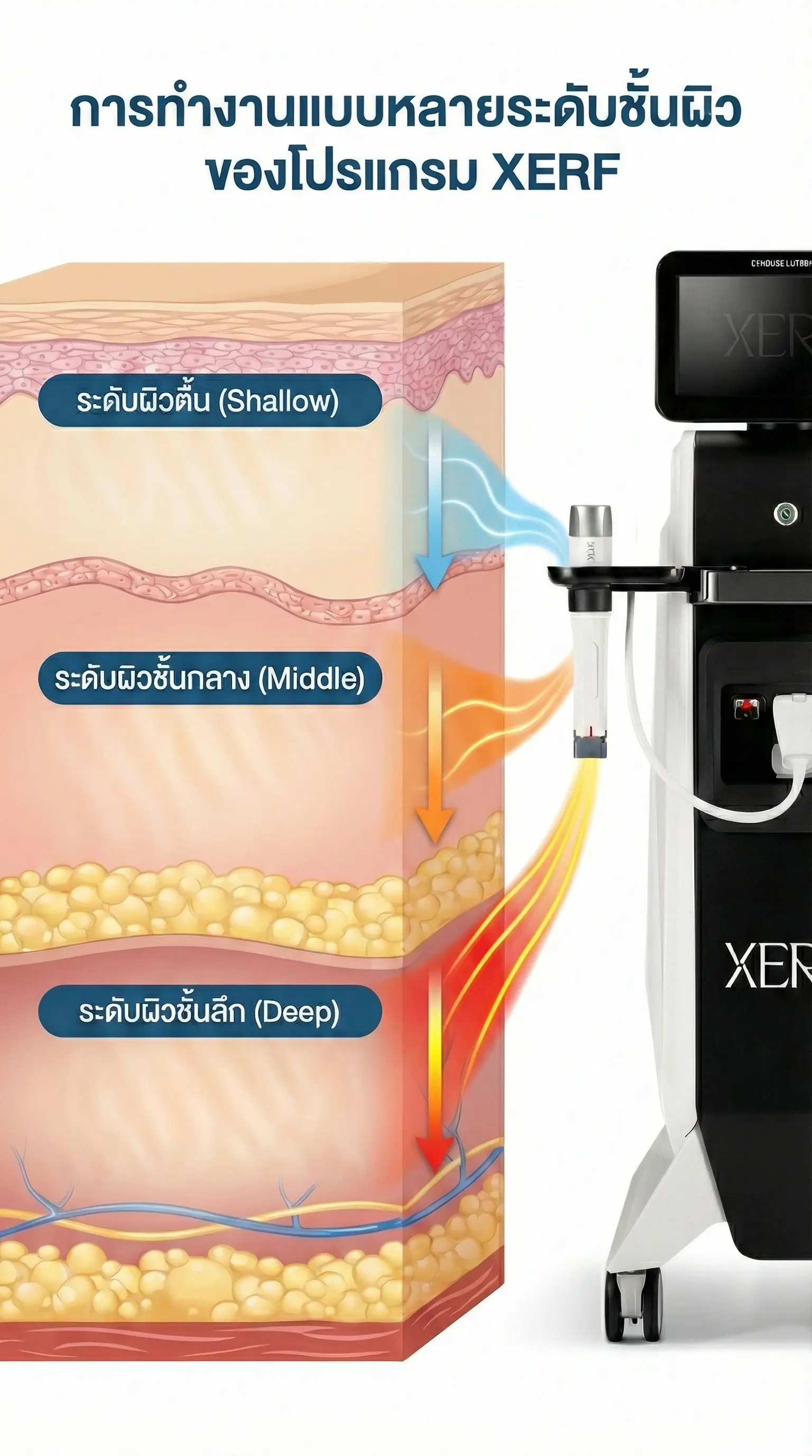 หลักการทำงานของโปรแกรม XERF